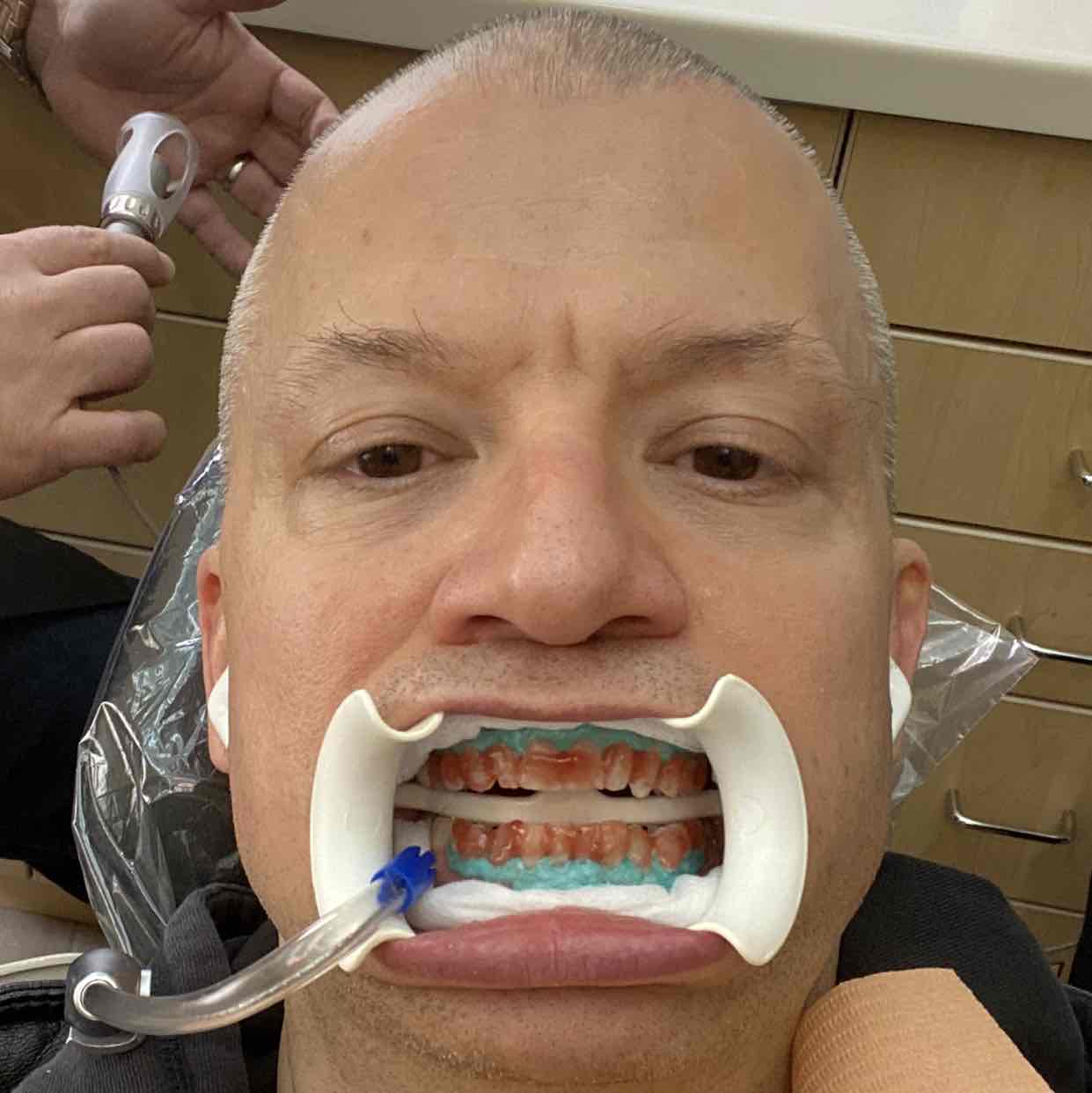 Avatar of Jim Norton